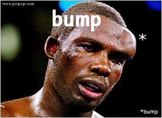 Name:  bump.jpg
Views: 23
Size:  15.3 KB