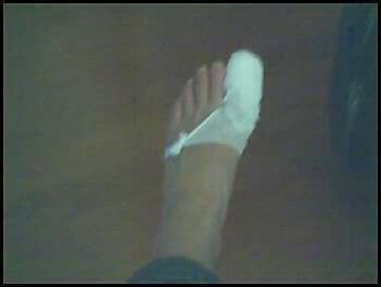 Name:  ouch.jpg
Views: 48
Size:  4.3 KB
