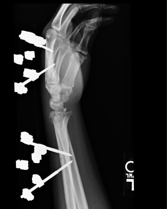 Name:  wrist1.jpg
Views: 36
Size:  24.5 KB
