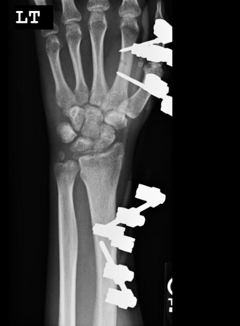 Name:  wrist2.jpg
Views: 31
Size:  22.5 KB