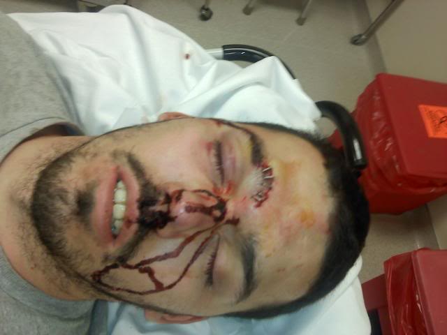 Name:  1028101646.jpg
Views: 46
Size:  28.3 KB