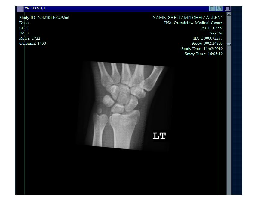 Name: brokenwrist.jpg
Views: 24
Size: 36.1 KB